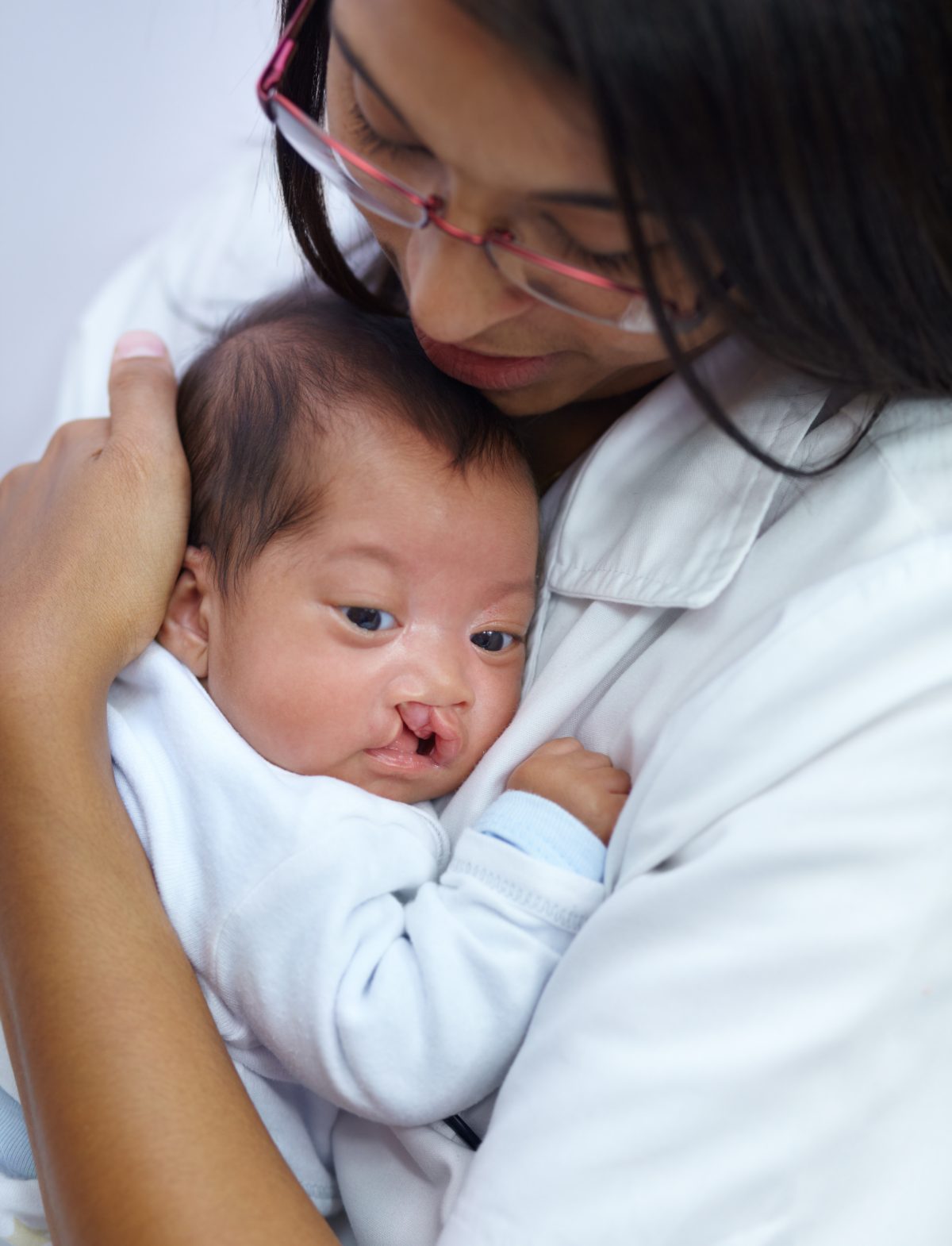 Understanding Cleft Lip & Palate Repairs: What Families Should Know