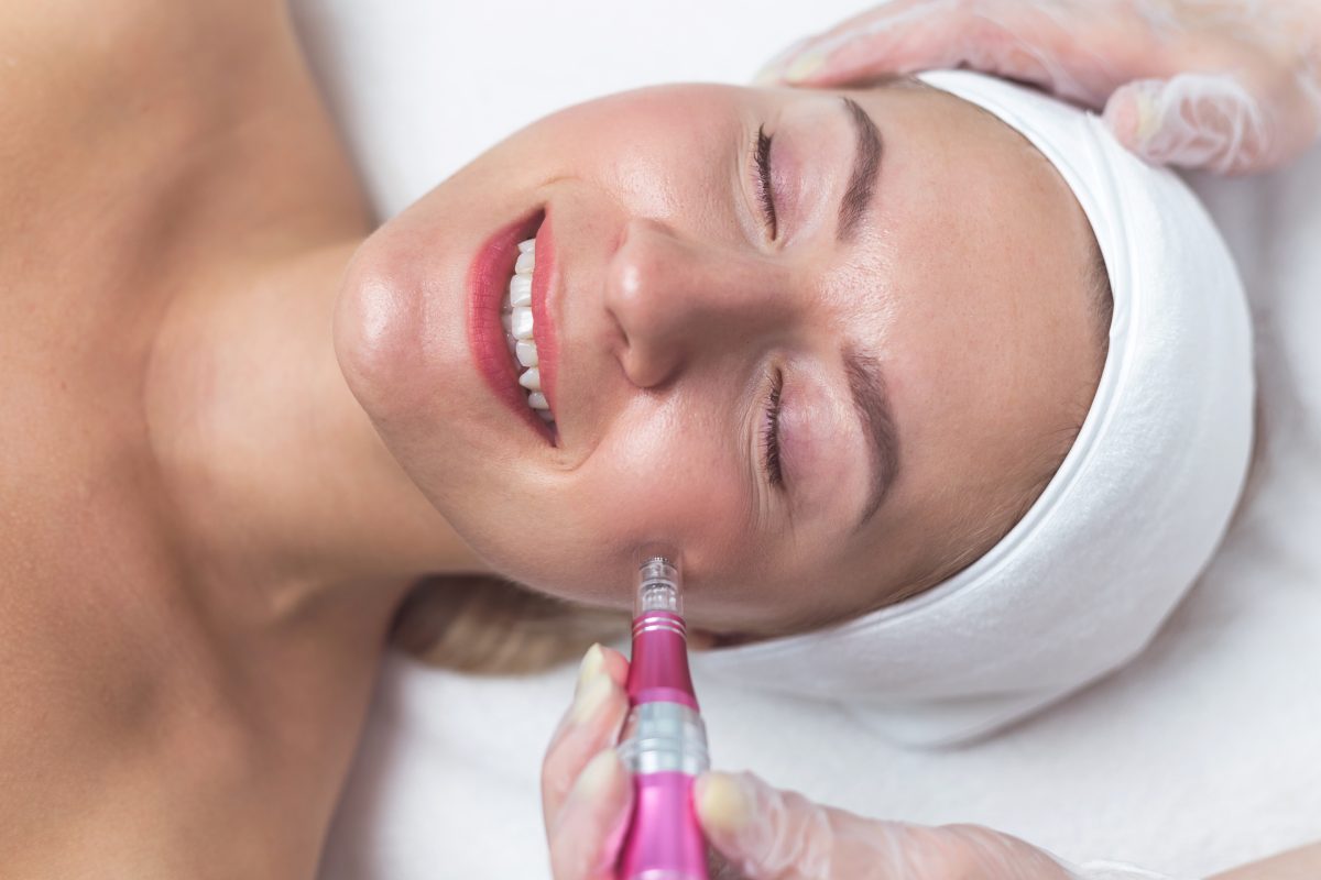 Revitalize Your Skin: The Benefits of Chemical Peels and Microneedling